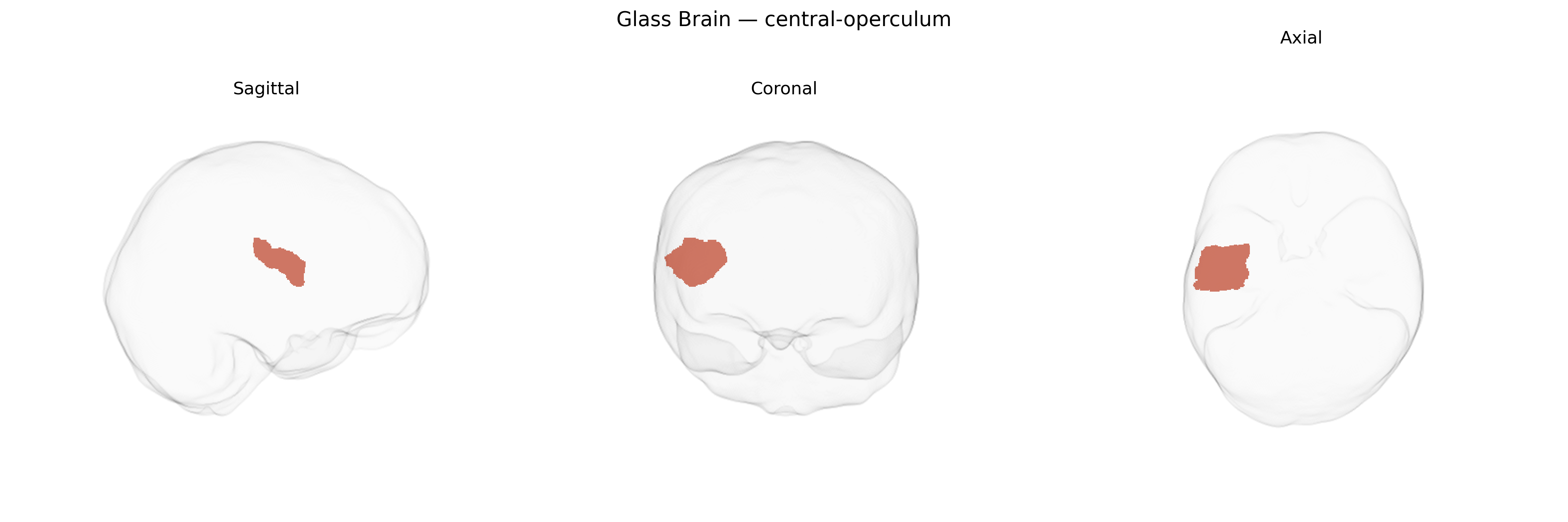 Triplanar Ghost Brain