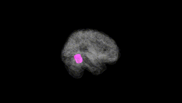 Full Brain Black