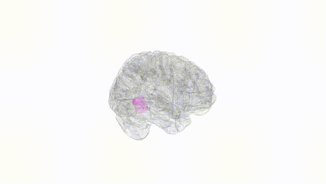 Full Brain White
