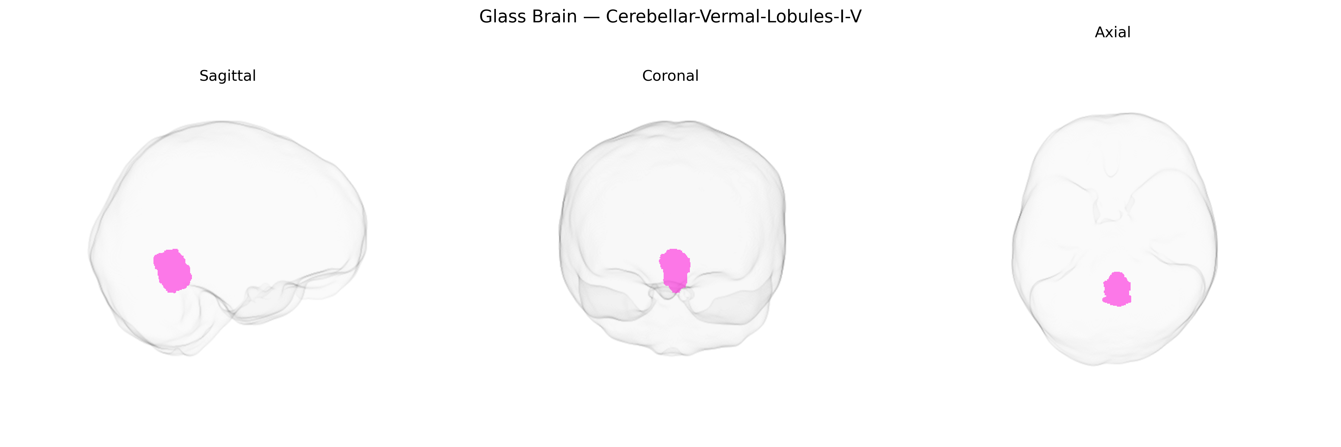 Triplanar Ghost Brain