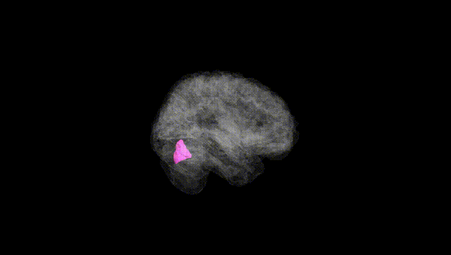 Full Brain Black