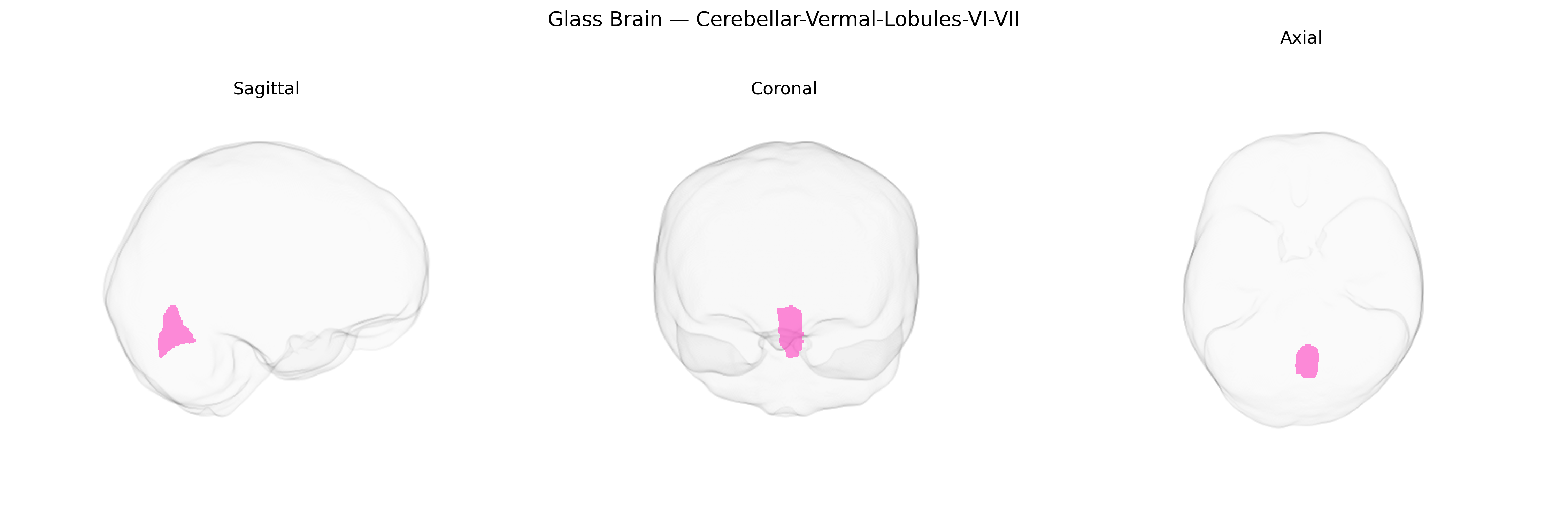 Triplanar Ghost Brain