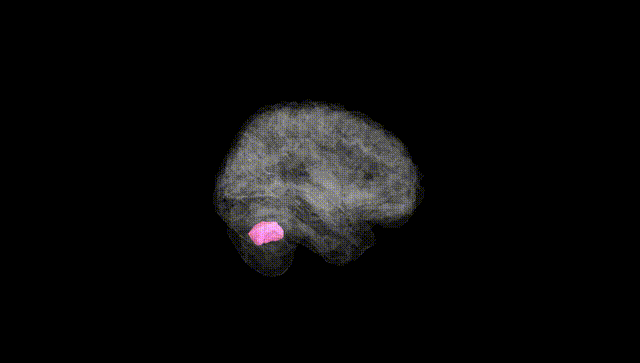 Full Brain Black