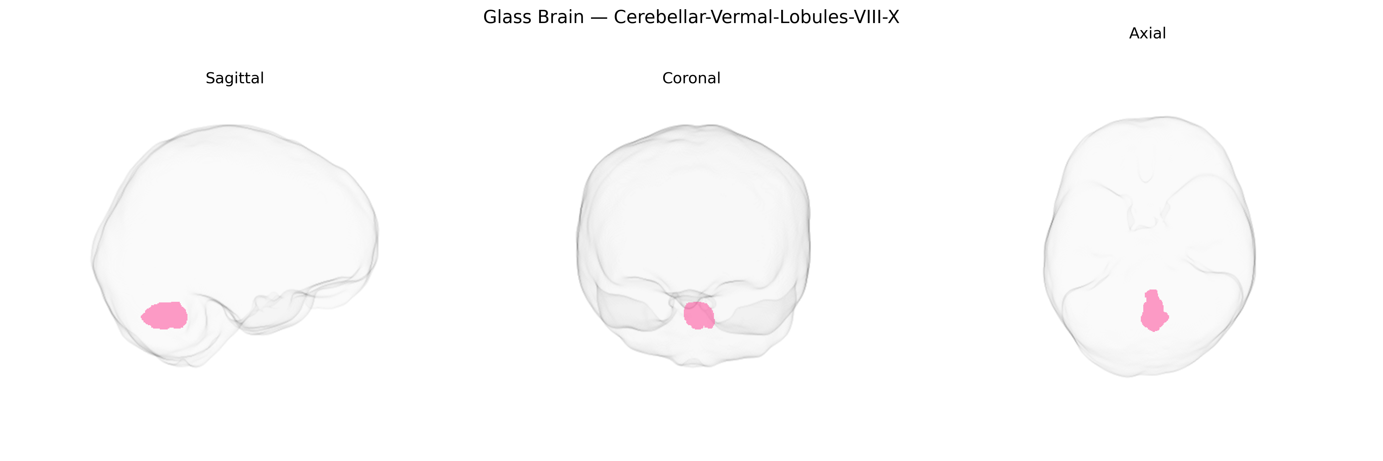 Triplanar Ghost Brain