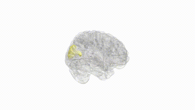 Full Brain White