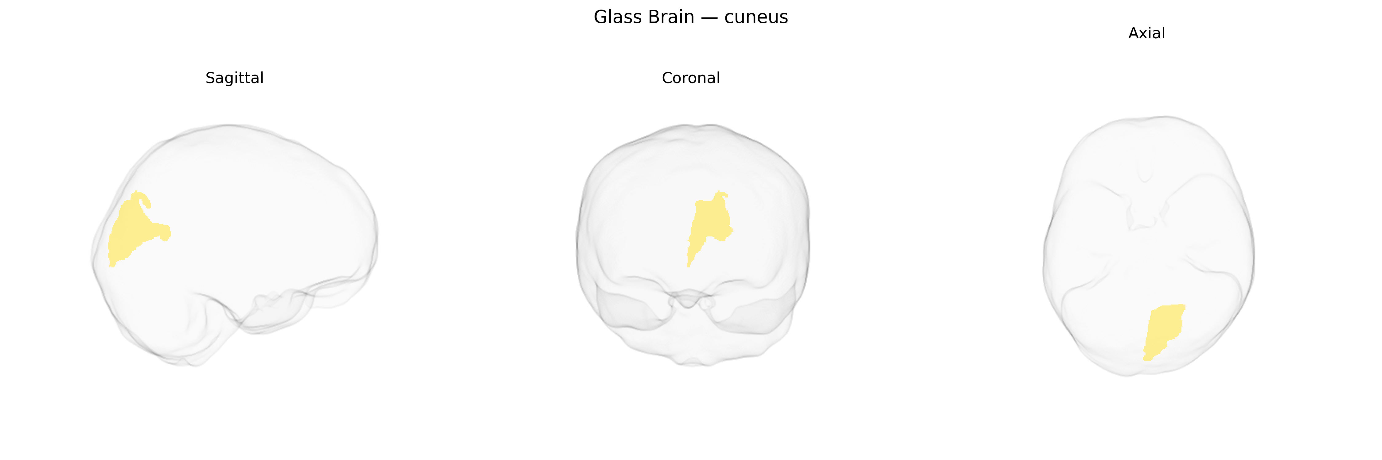 Triplanar Ghost Brain