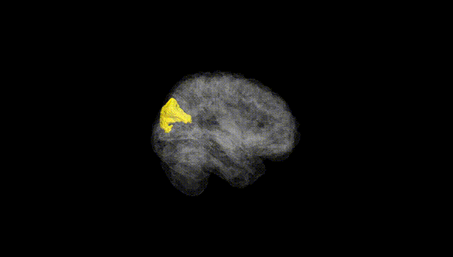 Full Brain Black