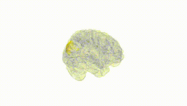 Full Brain White