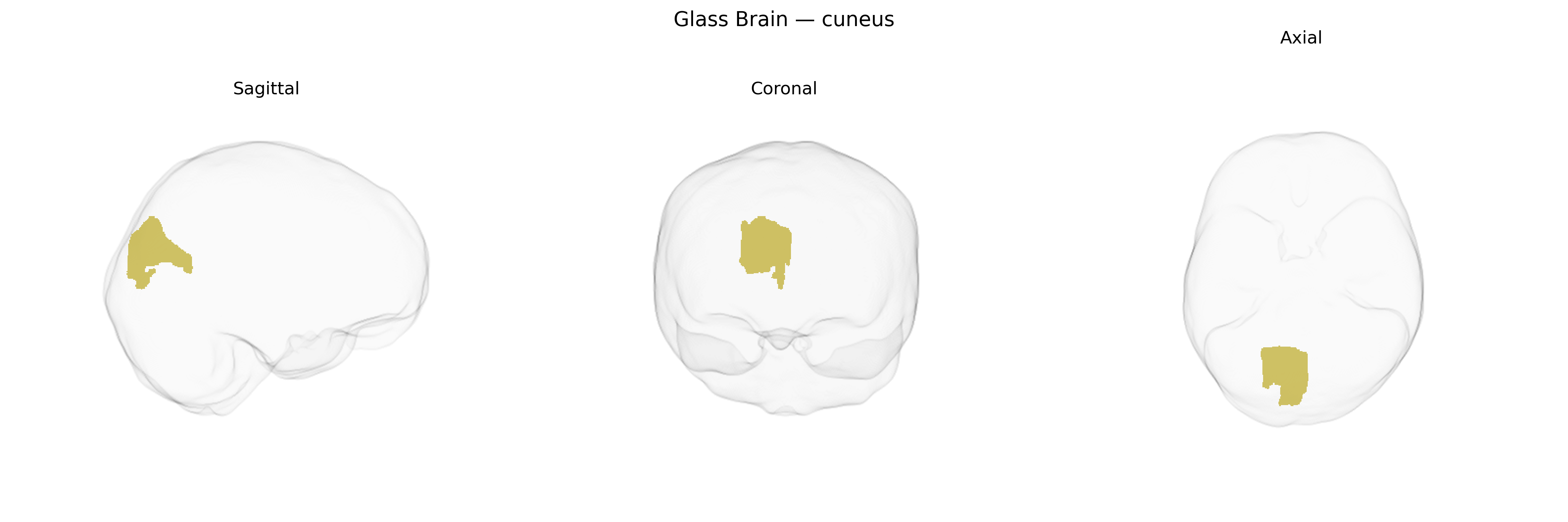 Triplanar Ghost Brain