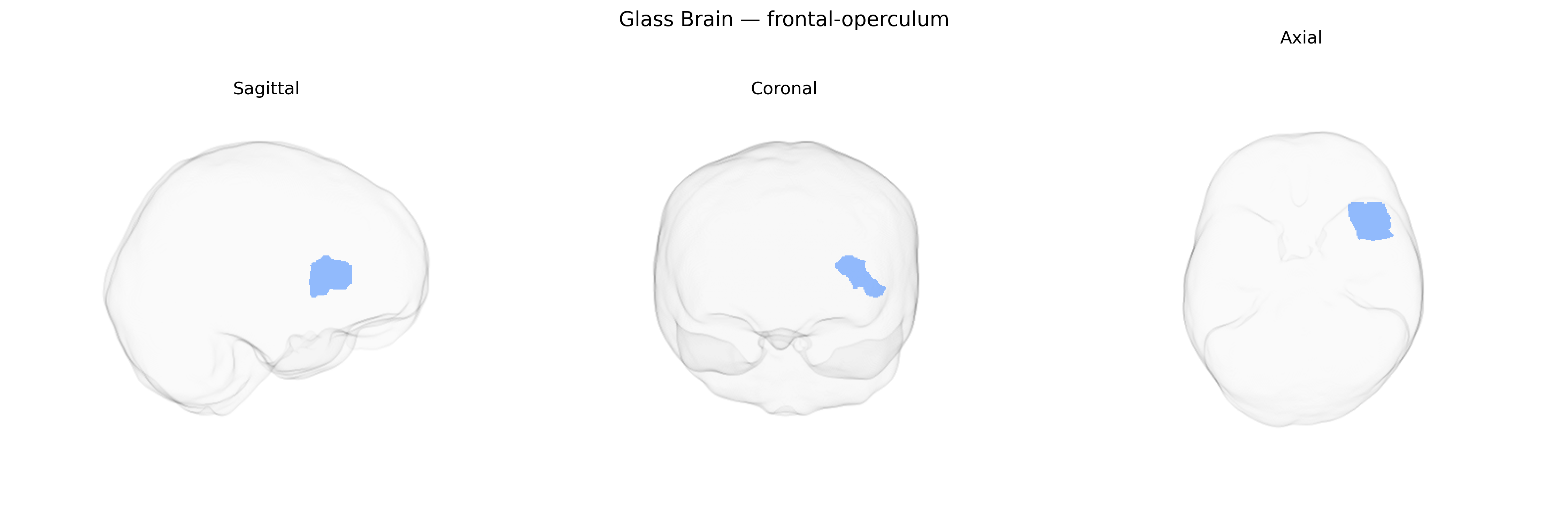 Triplanar Ghost Brain