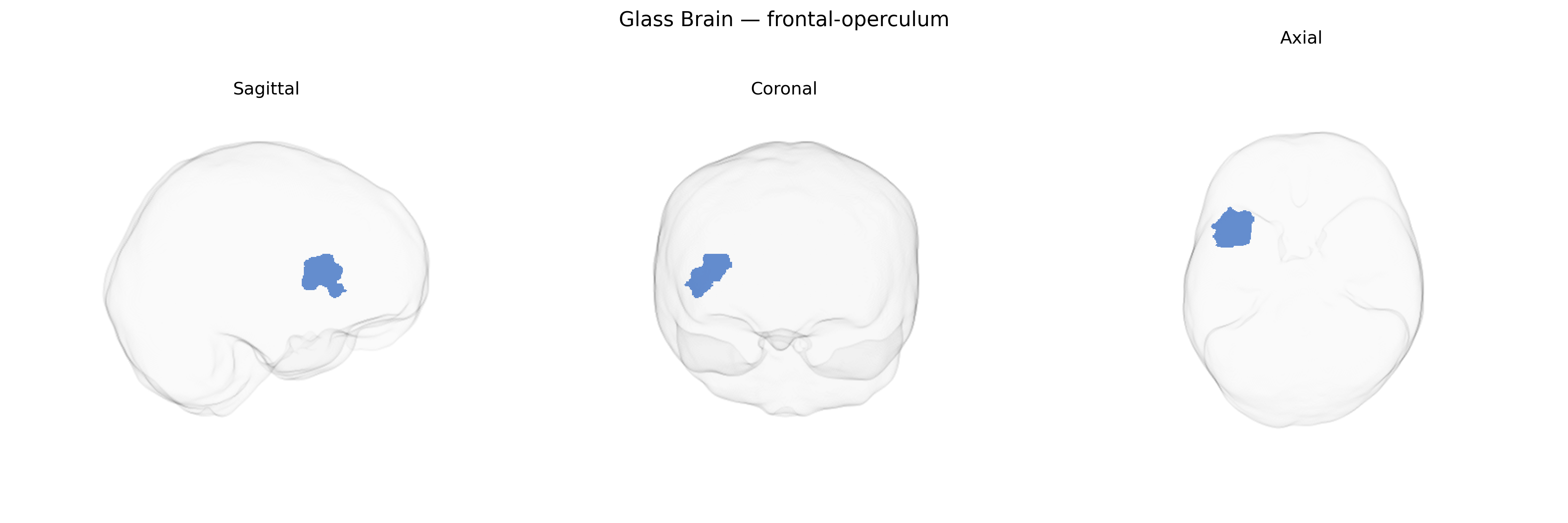 Triplanar Ghost Brain