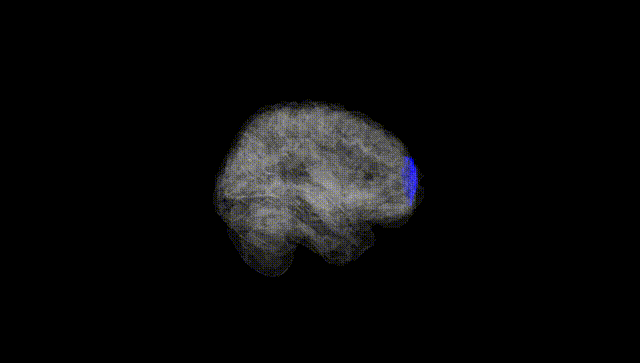 Full Brain Black
