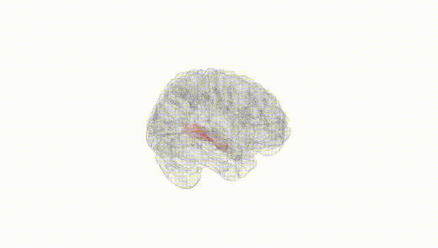 Full Brain White