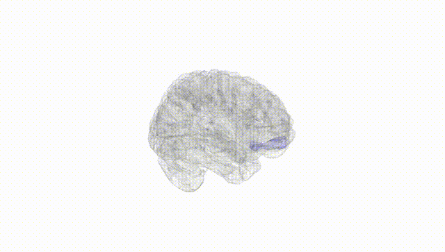 Full Brain White