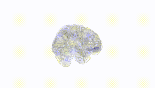 Full Brain White