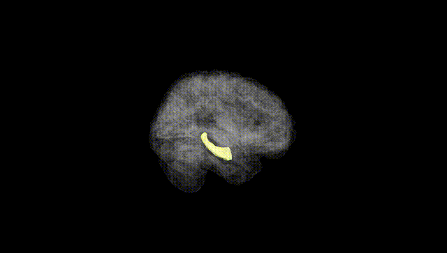 Full Brain Black