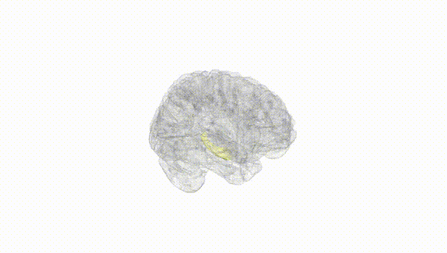 Full Brain White
