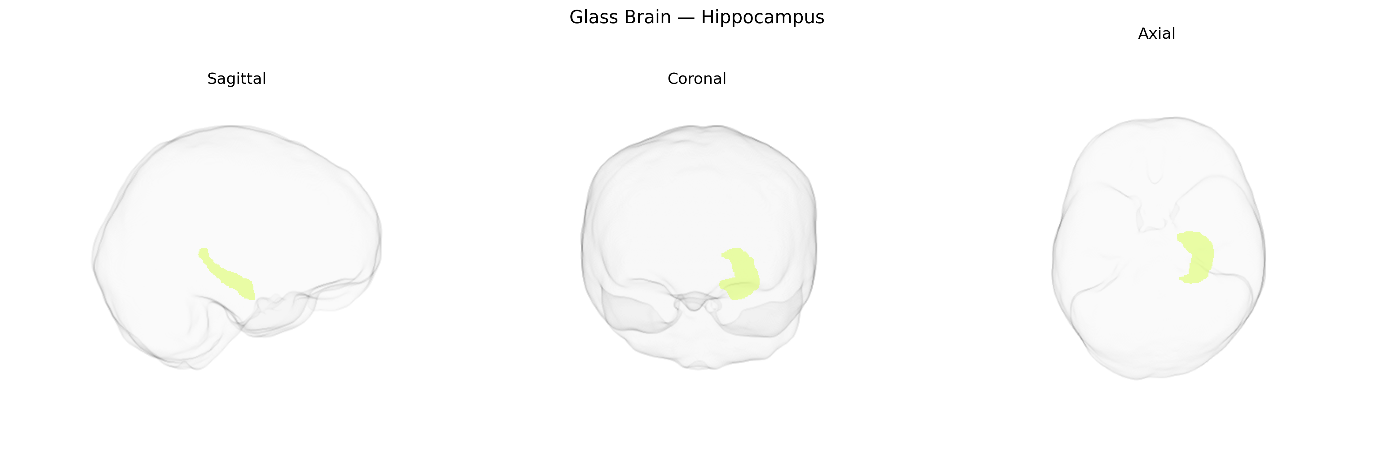 Triplanar Ghost Brain