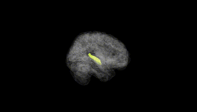Full Brain Black