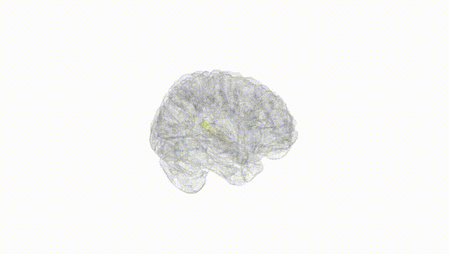 Full Brain White