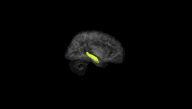 Hemisphere Black