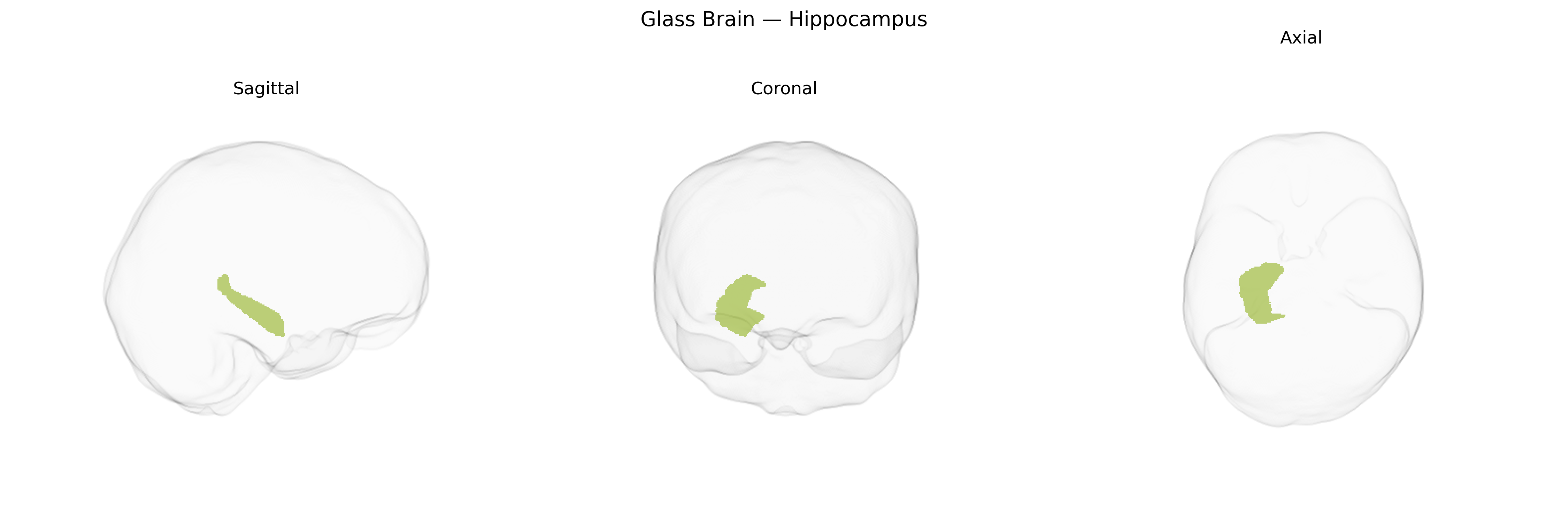 Triplanar Ghost Brain