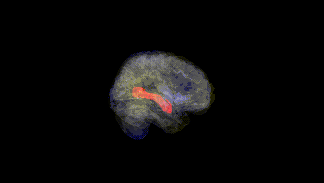 Full Brain Black