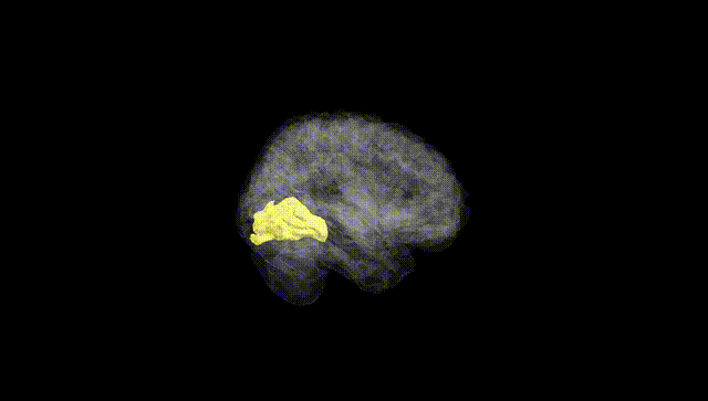 Full Brain Black