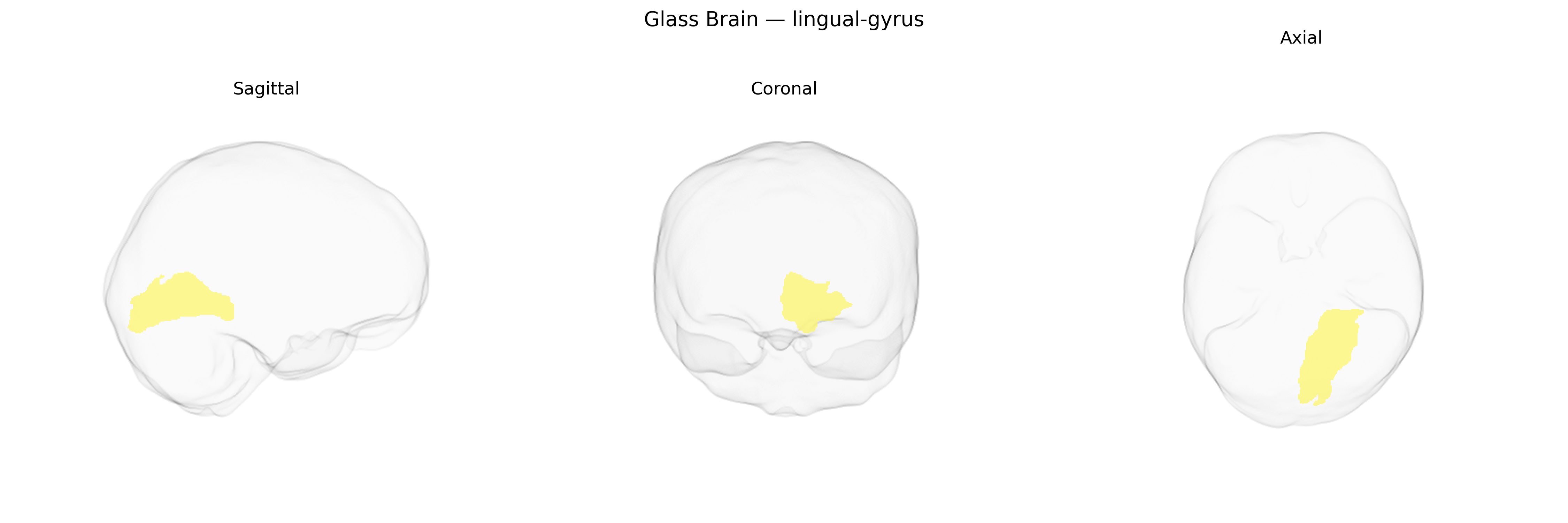 Triplanar Ghost Brain