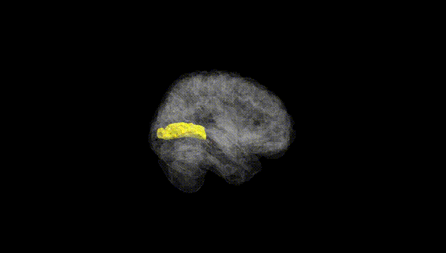 Full Brain Black