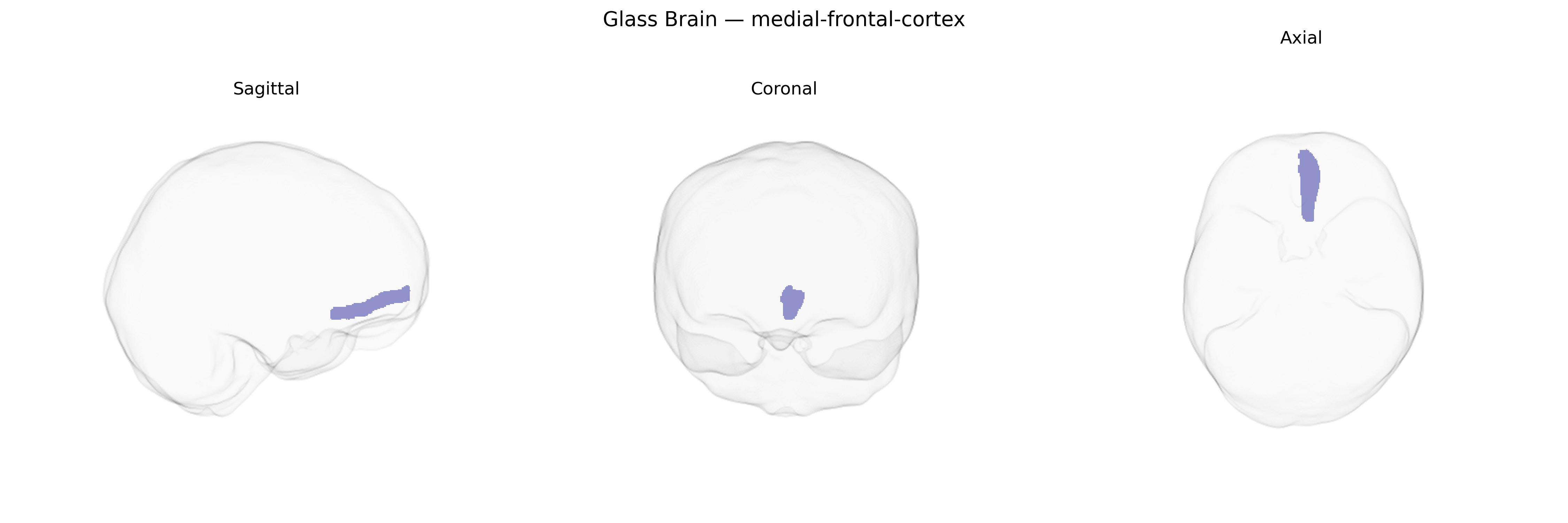 Triplanar Ghost Brain