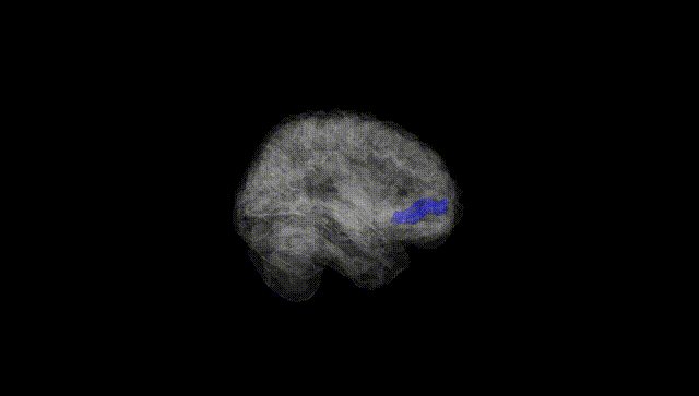 Full Brain Black