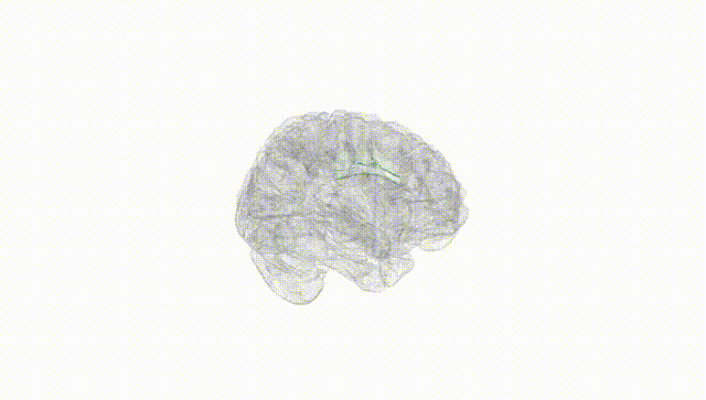 Full Brain White