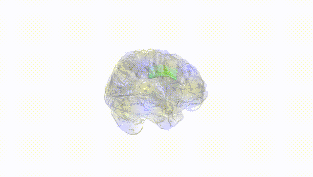 Full Brain White