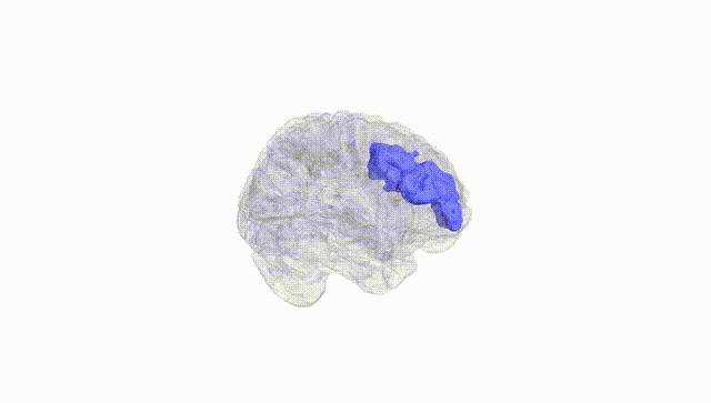 Full Brain White
