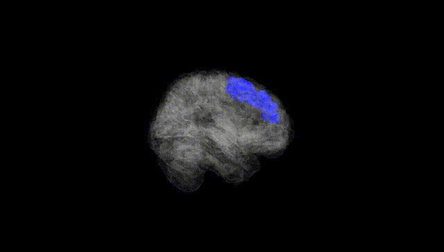 Full Brain Black
