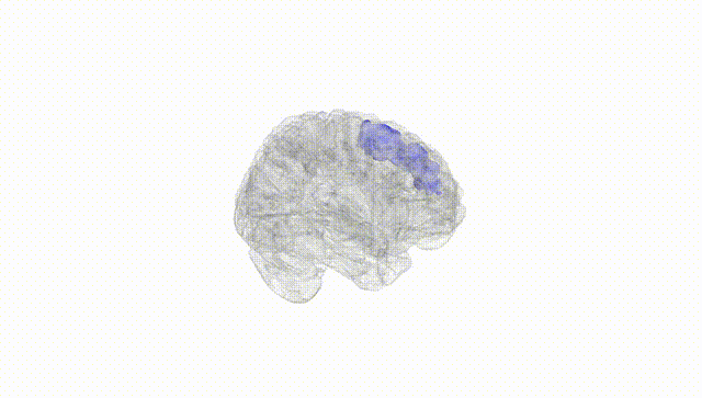 Full Brain White