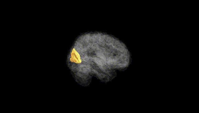 Full Brain Black