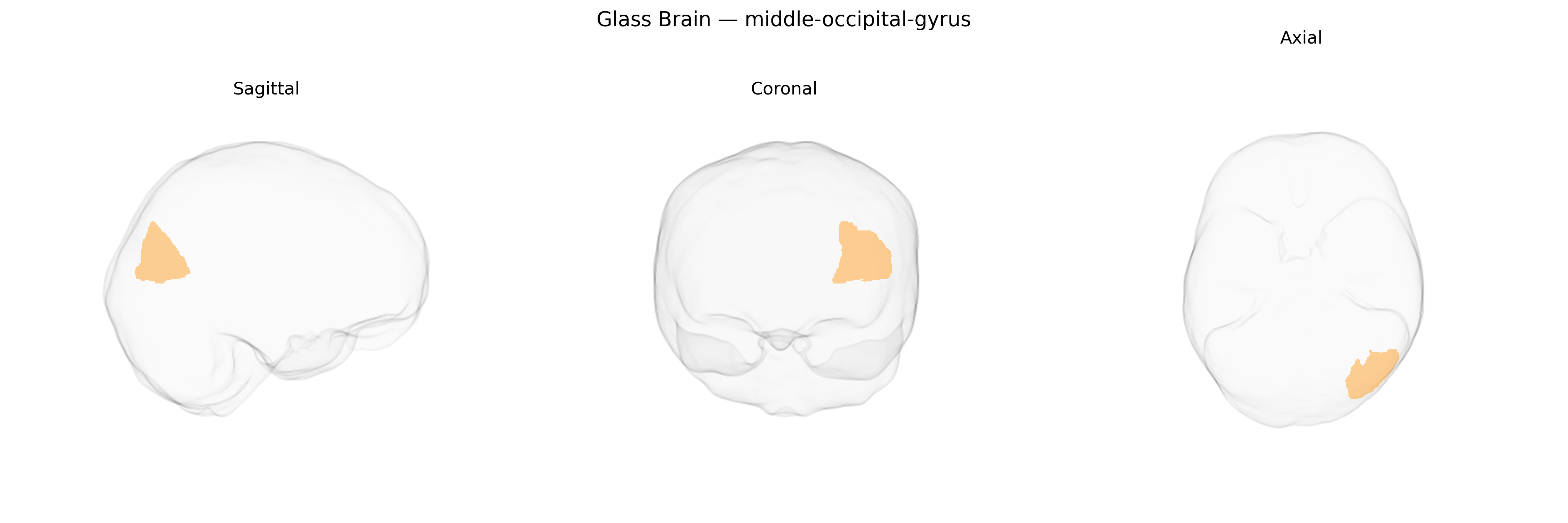 Triplanar Ghost Brain