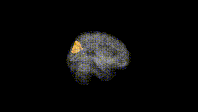Full Brain Black