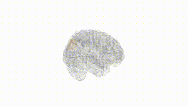 Full Brain White