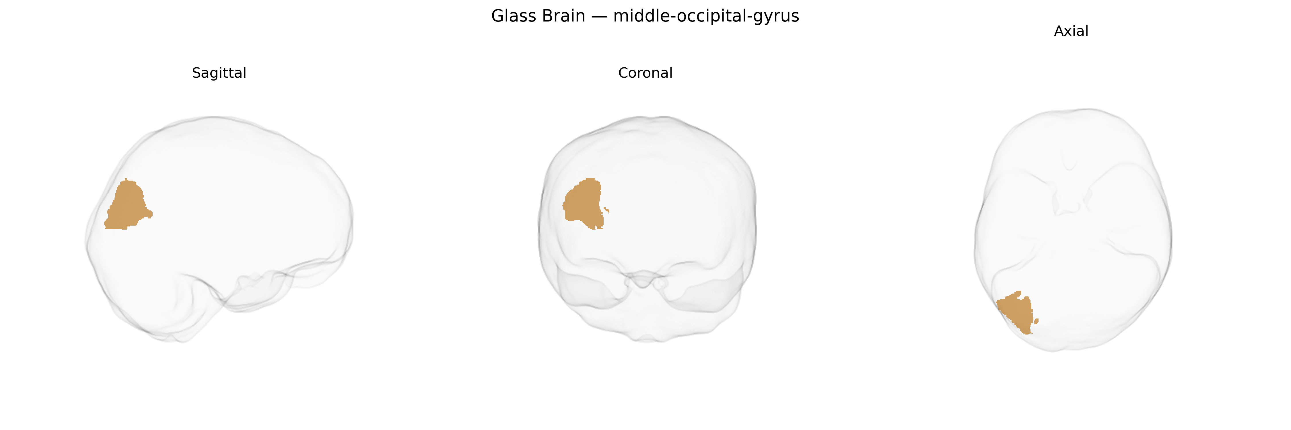 Triplanar Ghost Brain