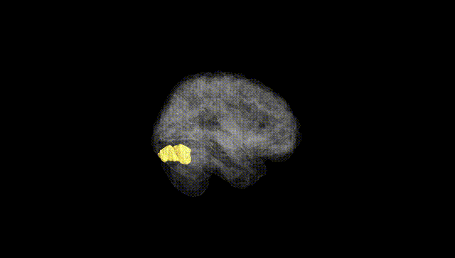 Full Brain Black