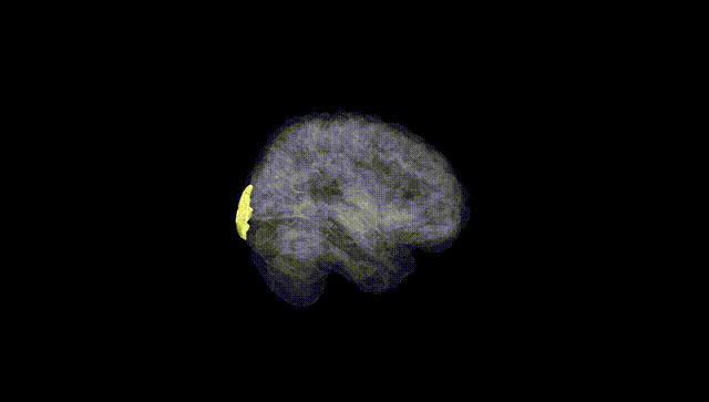 Full Brain Black