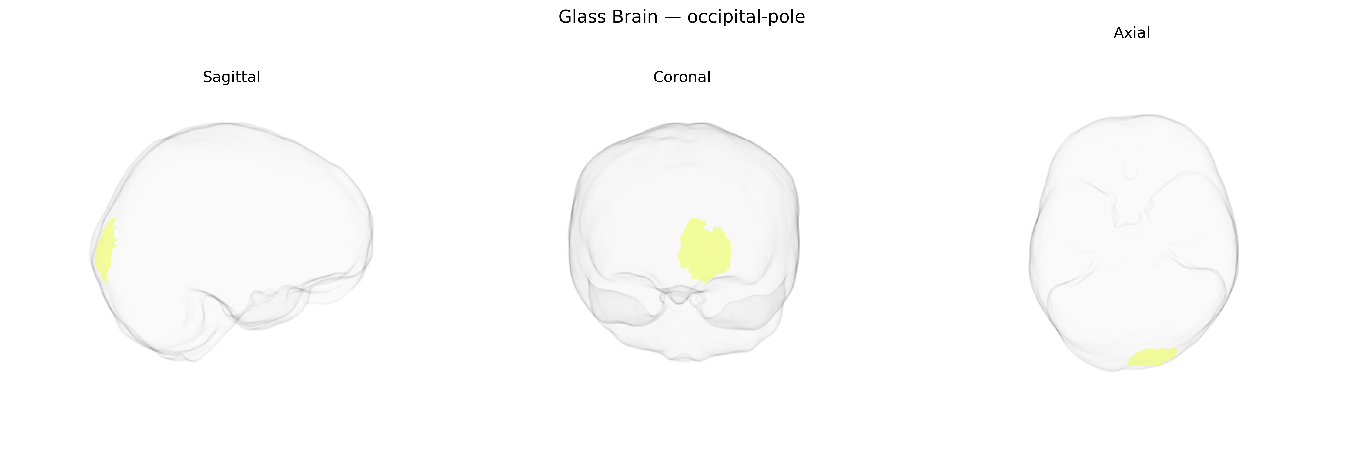 Triplanar Ghost Brain