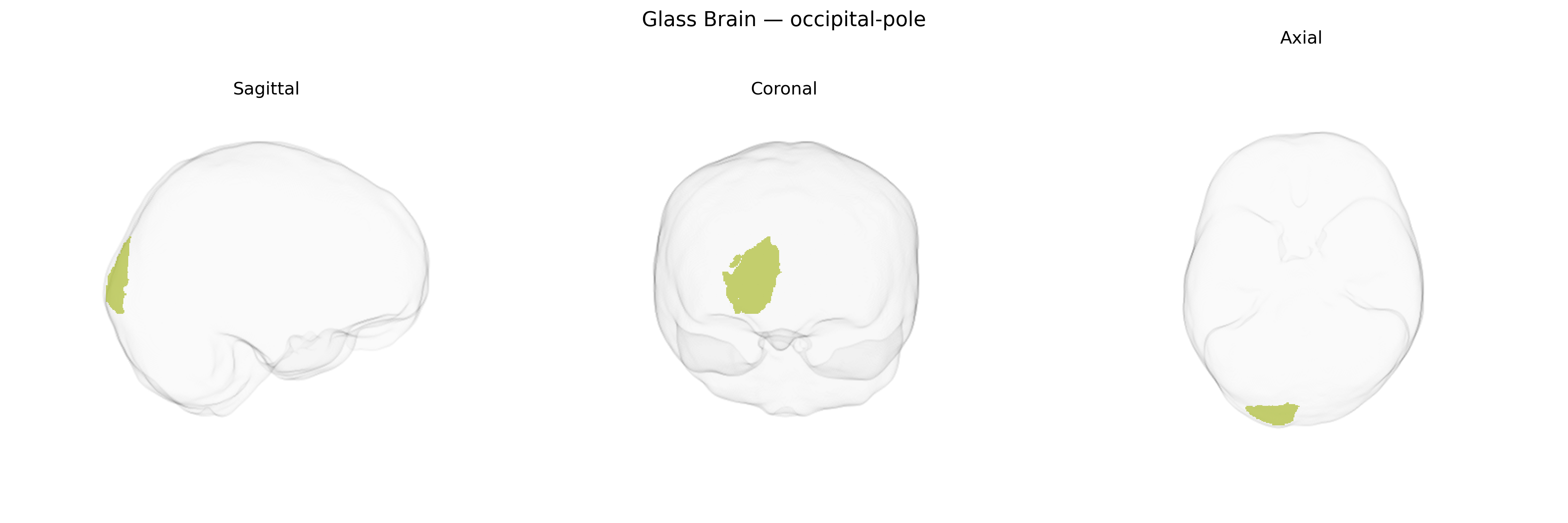 Triplanar Ghost Brain