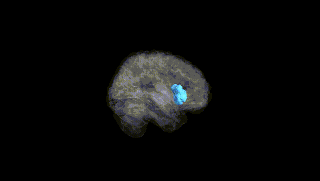 Full Brain Black
