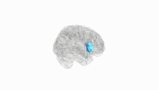 Full Brain White
