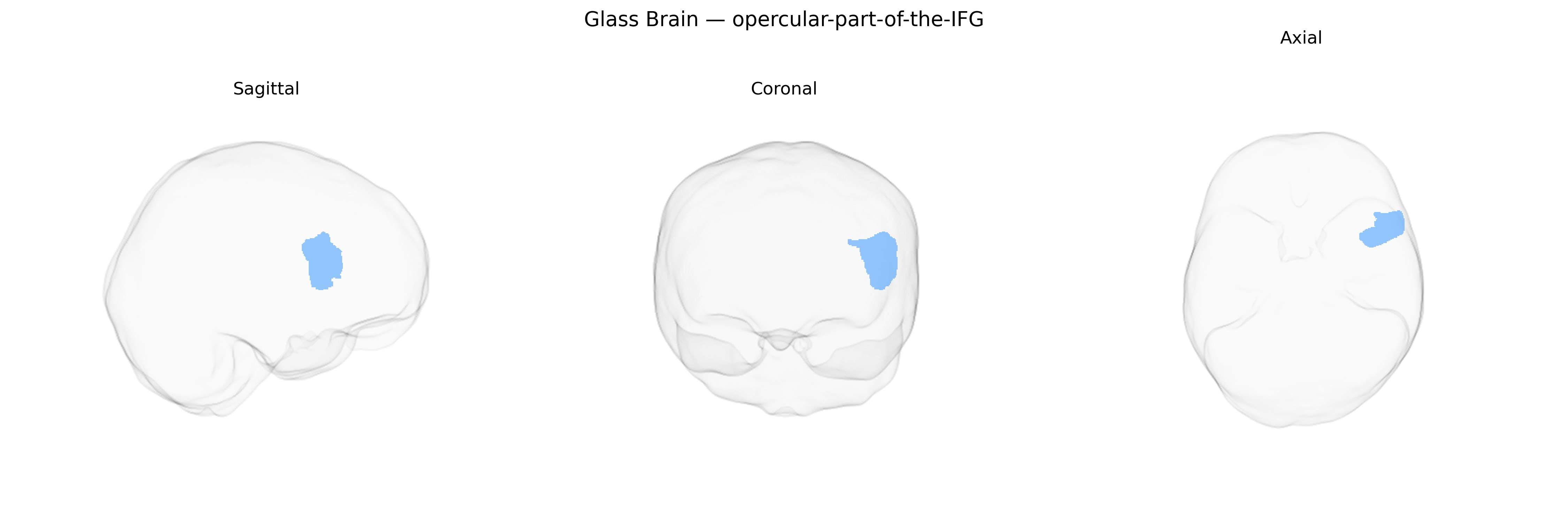 Triplanar Ghost Brain