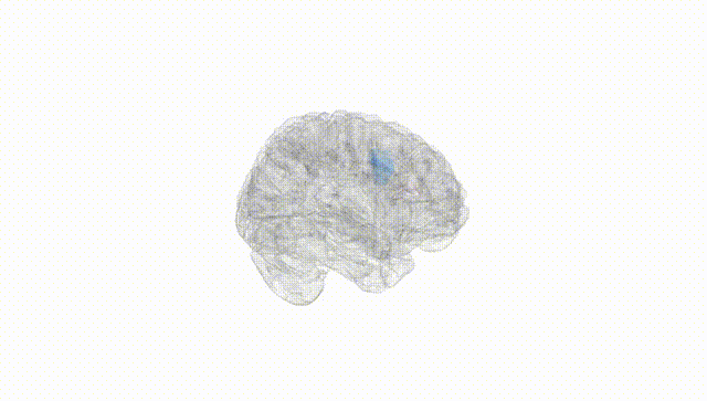Full Brain White